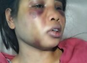 Penyiksaan Kejam Sering Diterima, Intan Bahkan Dipaksa Makan Kotoran Hewan